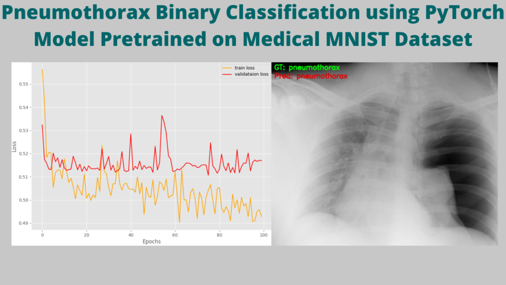 Pneumothorax Binary Classification using PyTorch Model Pretrained on Medical MNIST Dataset
