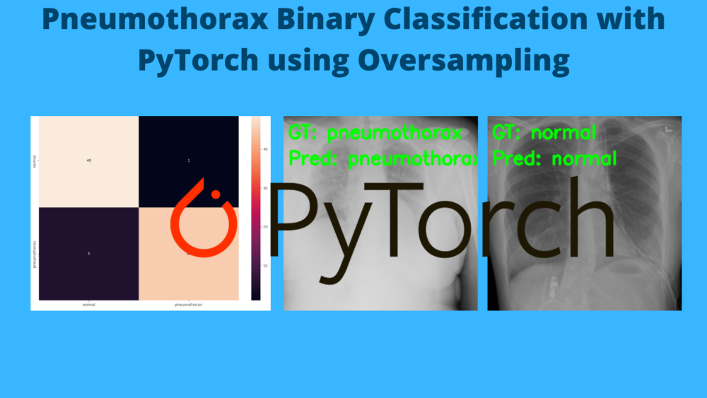 Pneumothorax Binary Classification with PyTorch using Oversampling