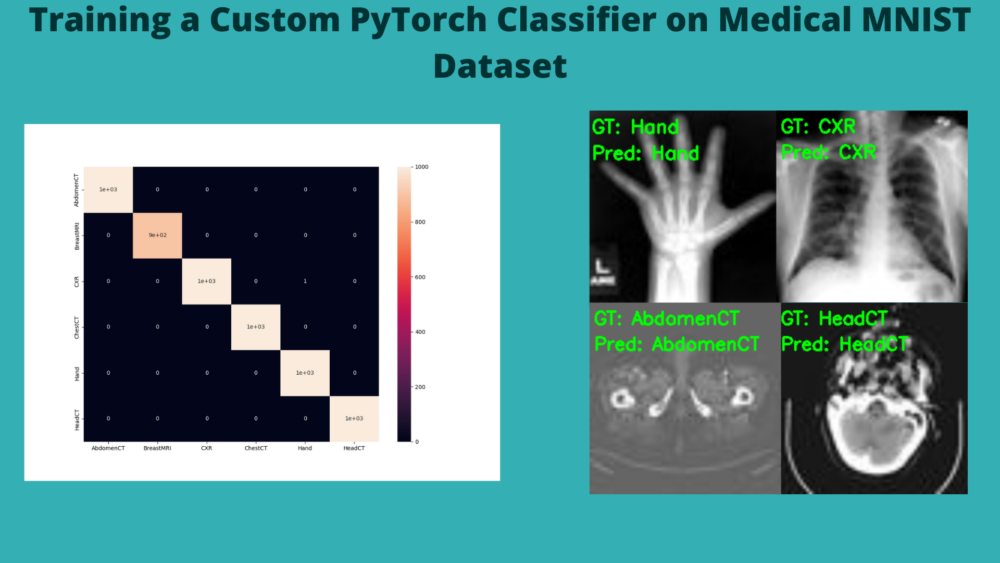 Training a Custom PyTorch Classifier on Medical MNIST Dataset