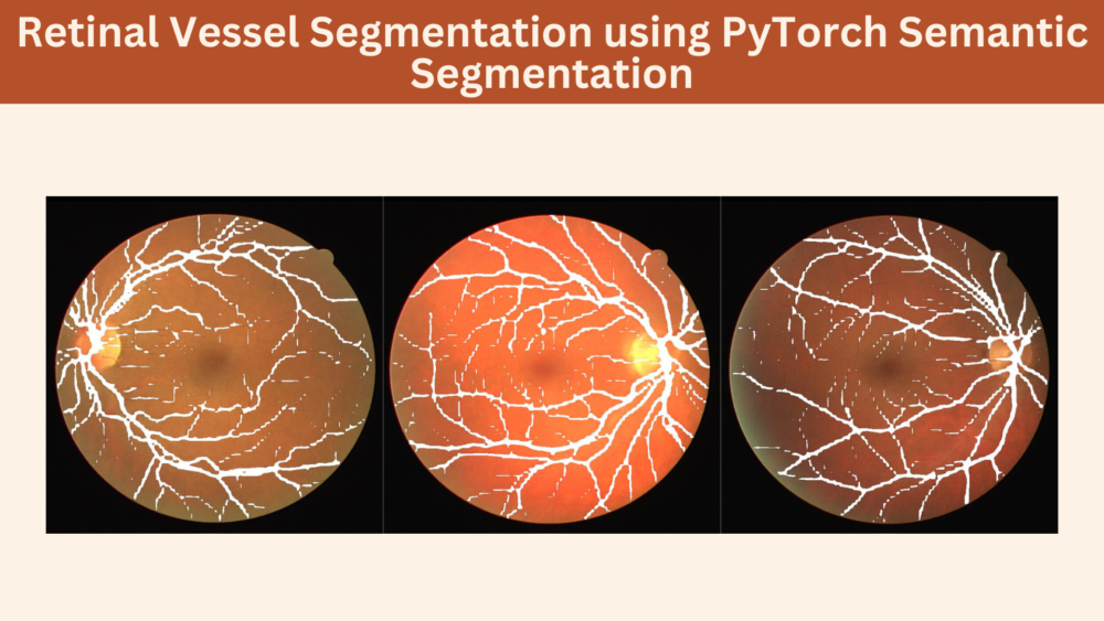 Retinal Vessel Segmentation using PyTorch Semantic Segmentation