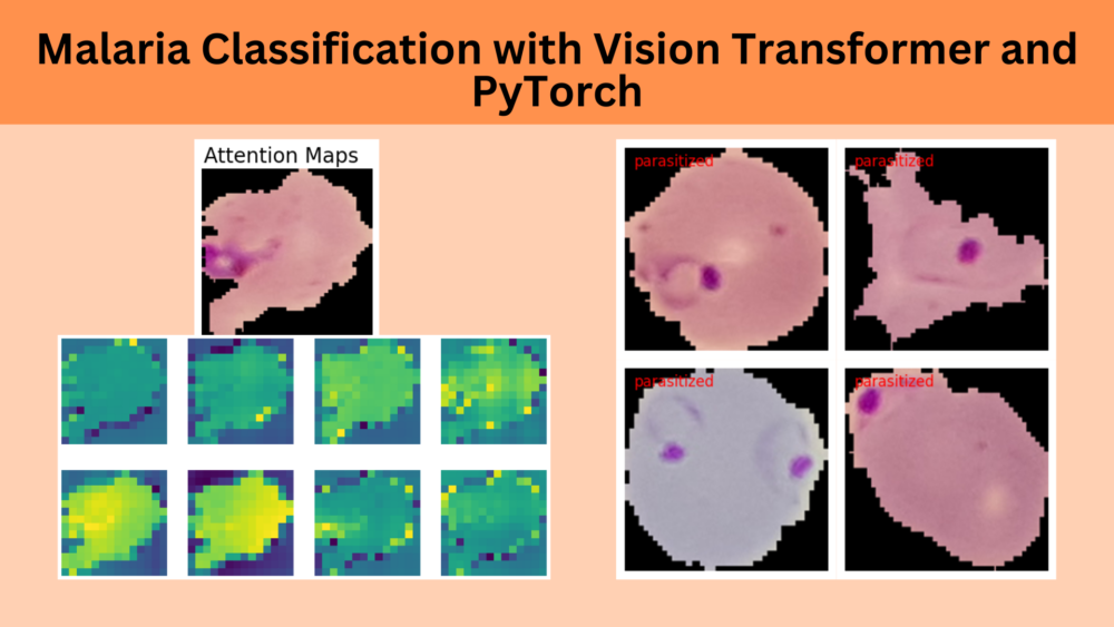Malaria Classification with Vision Transformer and PyTorch